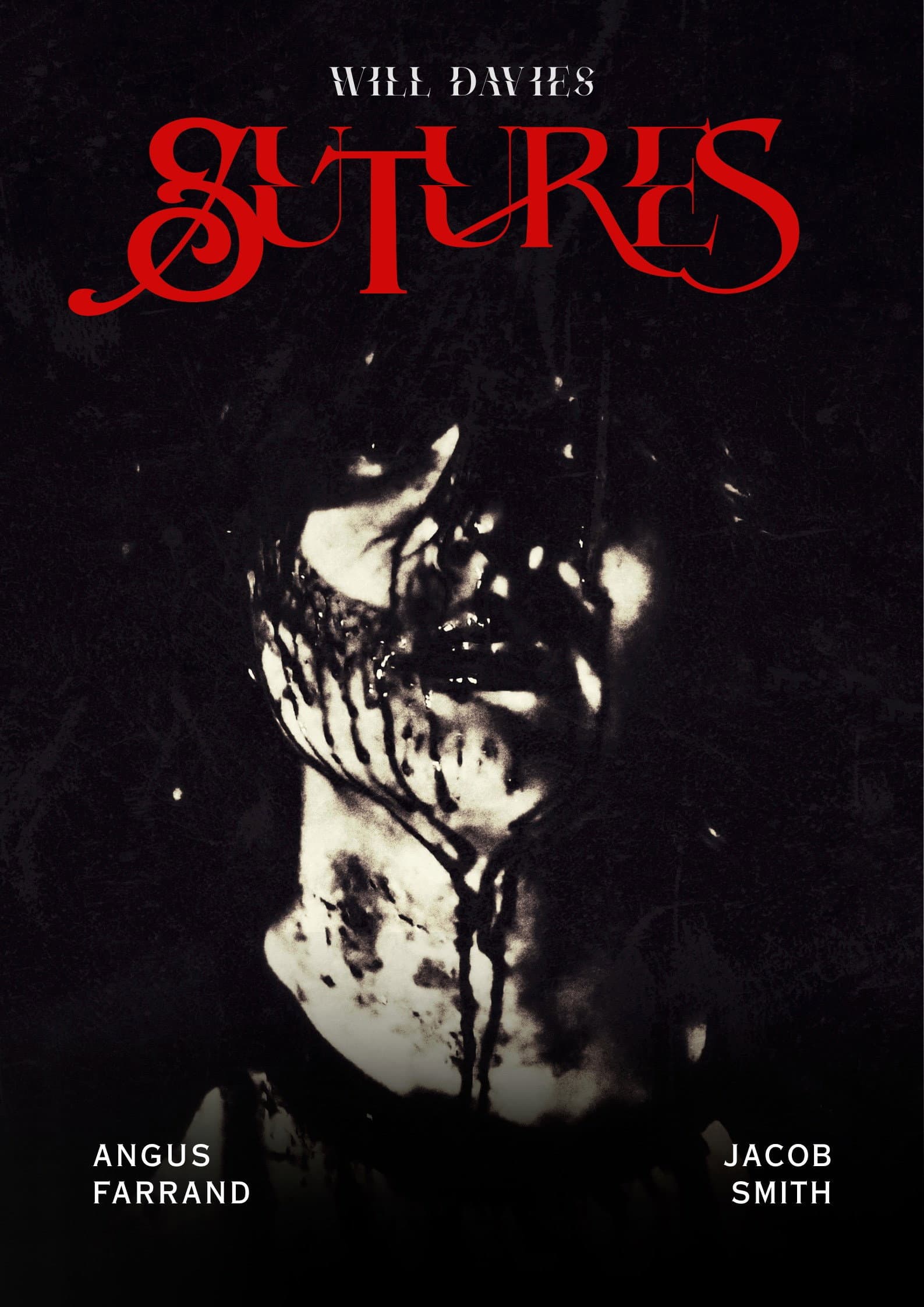 Sutures